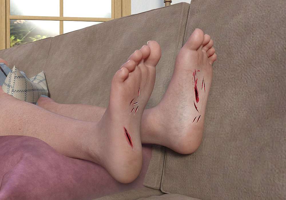Melanie’s two feet show the cuts where the broken bottle’s pieces cut into the soles of her feet.