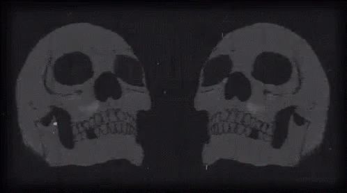 29019-84-ch-84-02-kb-skulls.gif